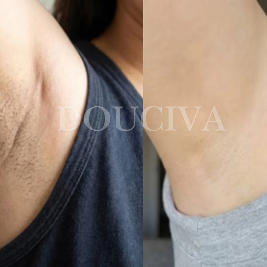 Douciva Huile Botanique Anti-Repousse | Alternative Naturelle au Laser