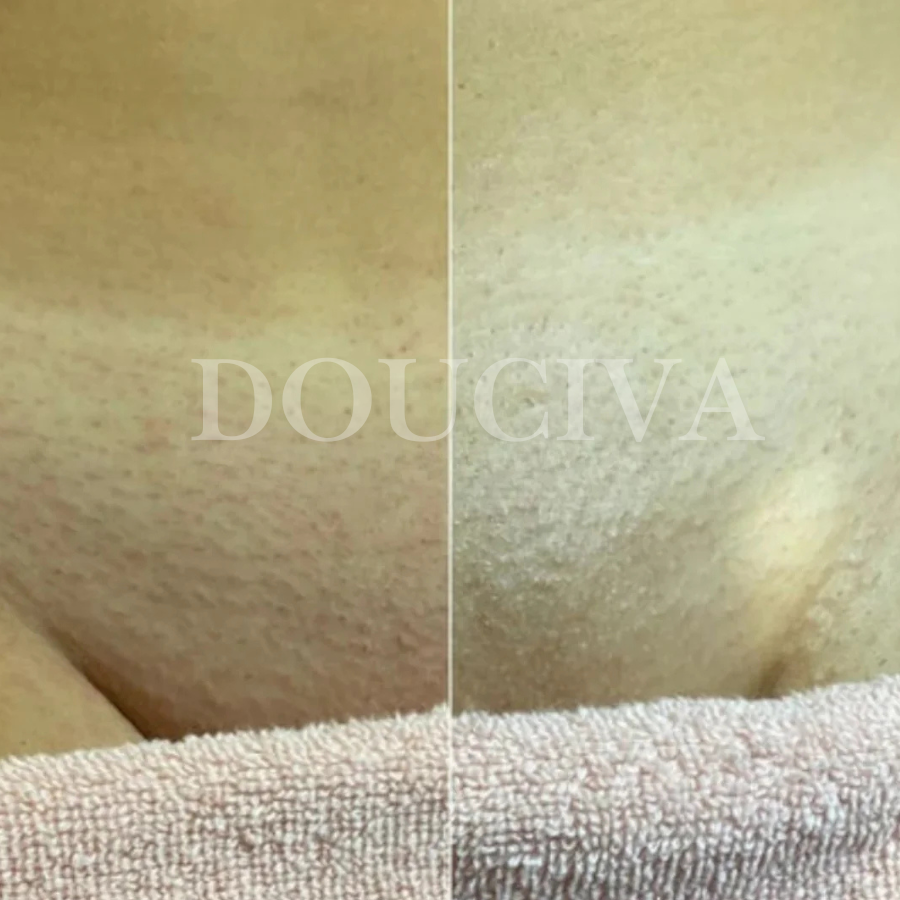 Douciva Huile Botanique Anti-Repousse | Alternative Naturelle au Laser